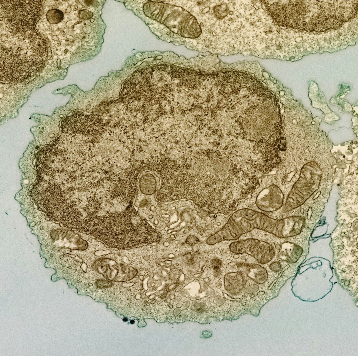 a close up of a cell with a microscope lens